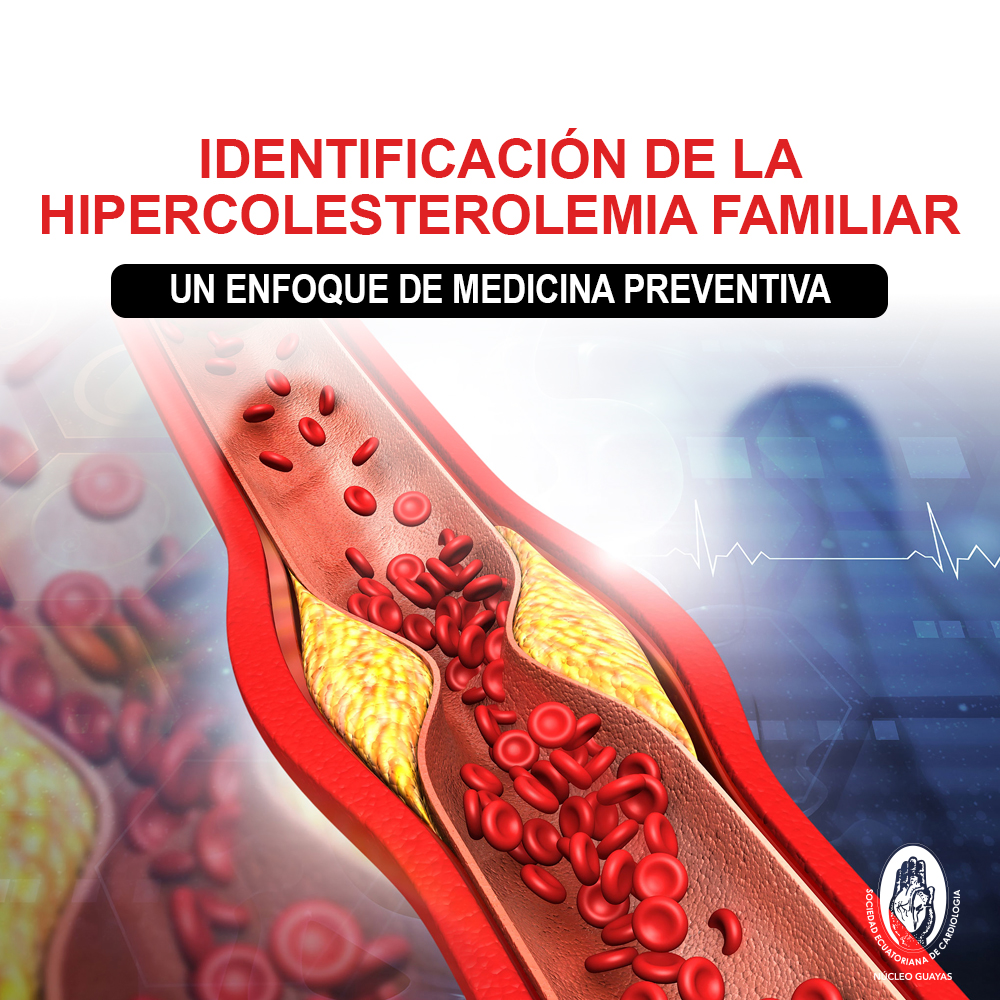 Identificación de la hipercolesterolemia familiar: un enfoque de medicina preventiva
