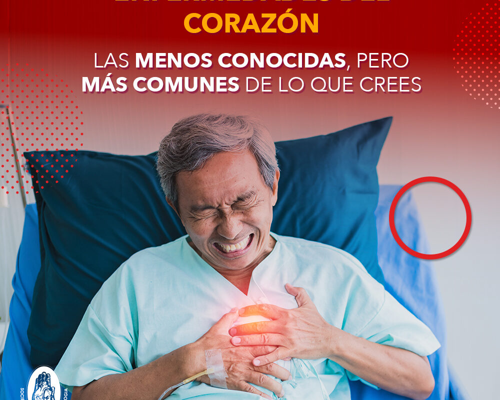 Enfermedades del corazón Las menos conocidas, pero más comunes de lo que crees