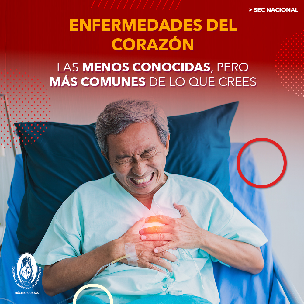 Enfermedades del corazón Las menos conocidas, pero más comunes de lo que crees