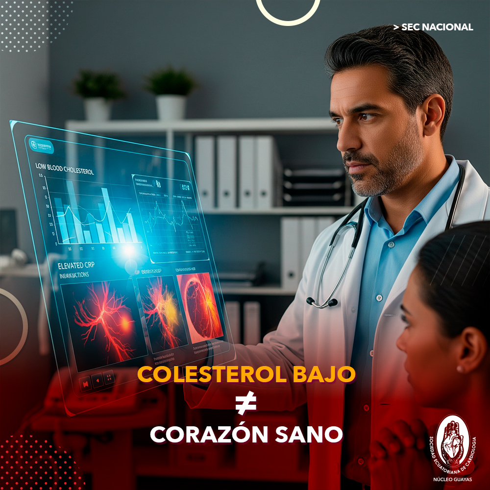 Colesterol bajo y riesgo cardiovascular