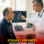 strain cardíaco